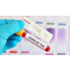 Тест-система для диагностики коронавируса  «SARS-CoV-2 antigen test»