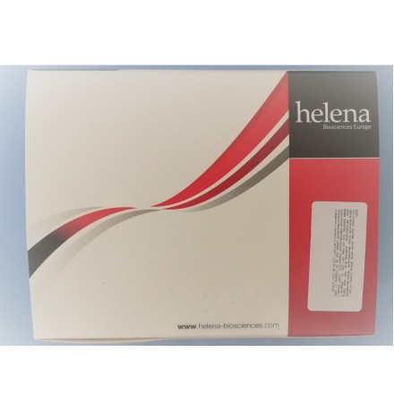 Тест-система Helena Manual D-Dimer «Д-димер, ручной метод» для полуколичественного определения D-димера в плазме, латекс-агглютинация на картах, 40–42 теста