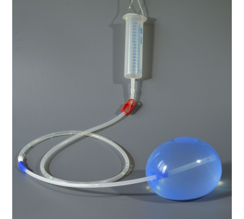 Катетер маточный баллонный Жуковского с трубкой, резервуаром и проводником